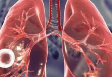 Тревожная статистика: Одесщина в топе за туберкулезом