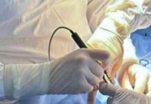 В Одессе врачи спасли младенца с редкой аномалией кишечника