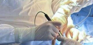 В Одессе врачи спасли младенца с редкой аномалией кишечника