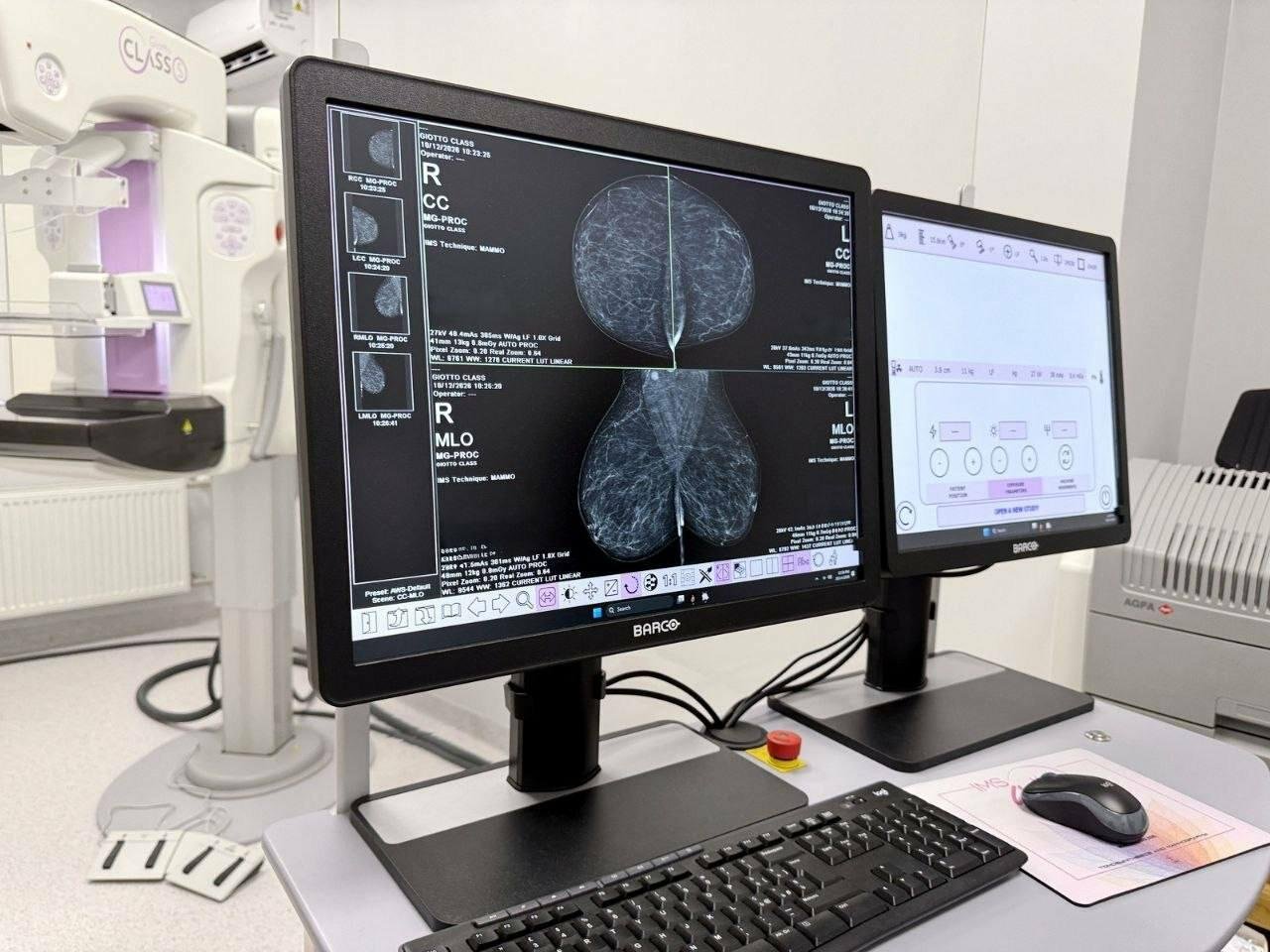 В Одессе заработал новый 3D-маммограф: где бесплатно проверить грудь